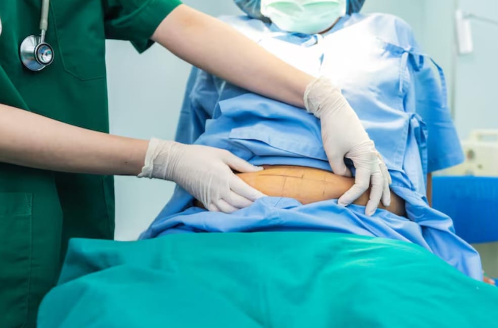 rocedure Works and What to Expect