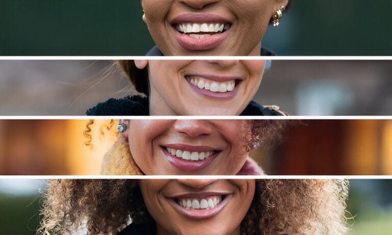 Smile Transformations Made Simple