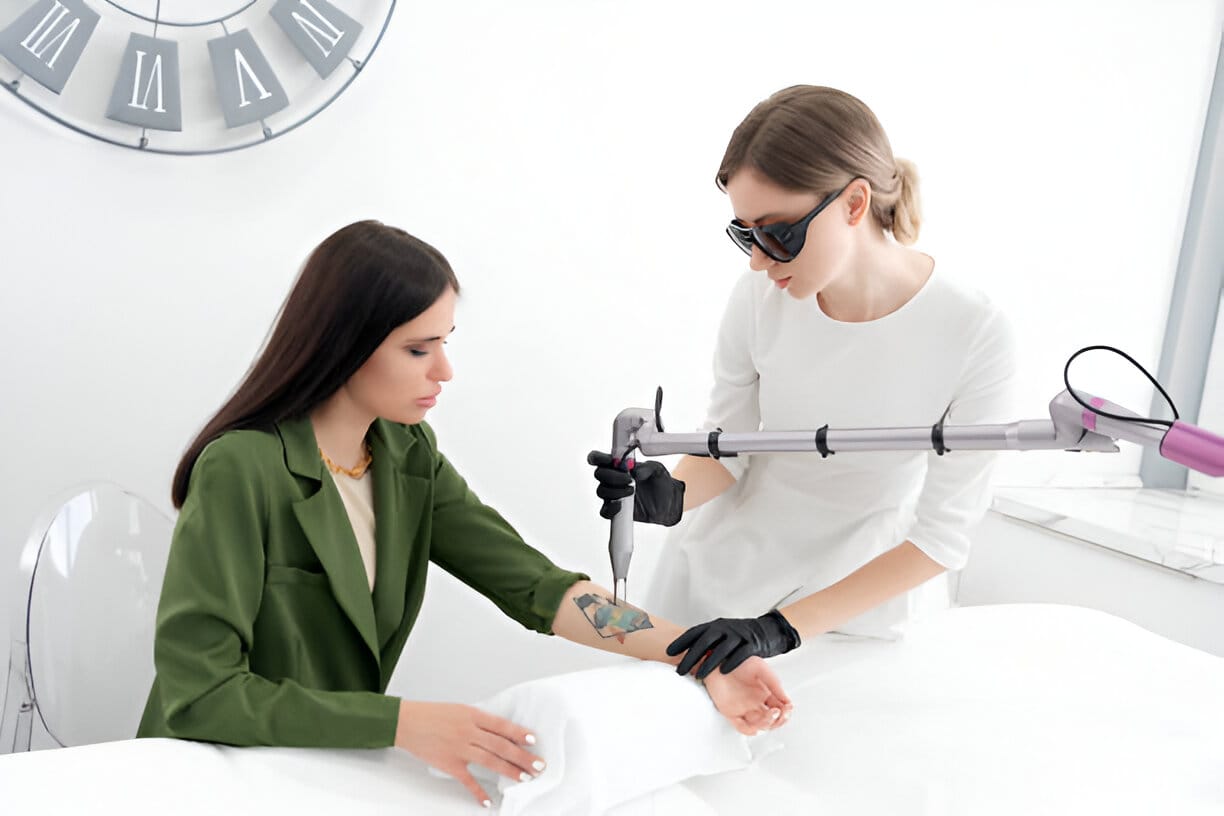 Tattoo Removal Method