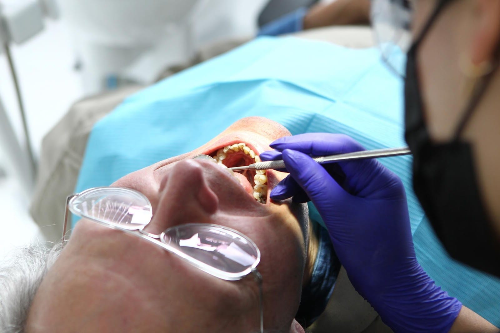 Oral Health Influences Mental