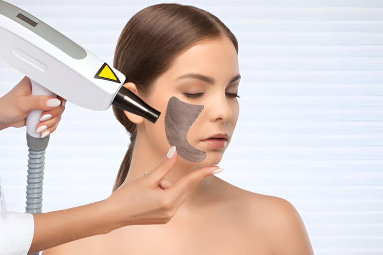 Mastering the Art of Tattoo Removal