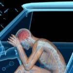 Medical Evaluation of Brain Injuries After a Car Crash