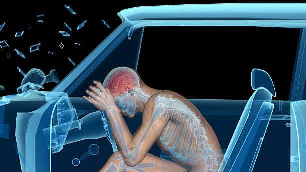 Medical Evaluation of Brain Injuries After a Car Crash